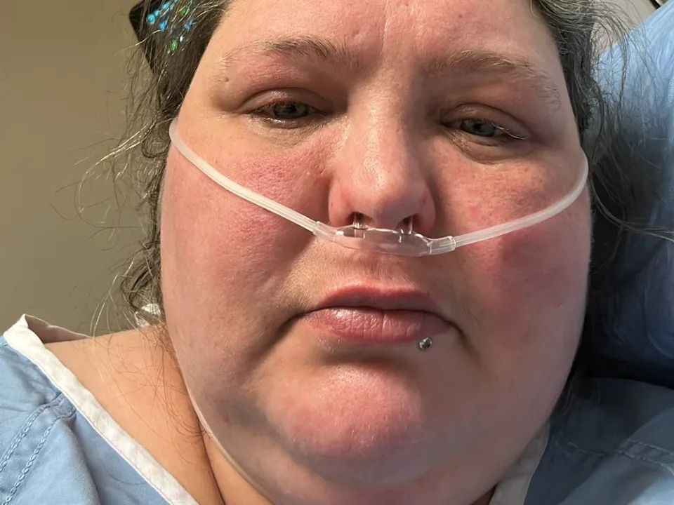 Saskatchewan woman Jolene Van Alstine has been waiting years for surgery to remove her remaining thyroid glands that has caused her extreme pain.