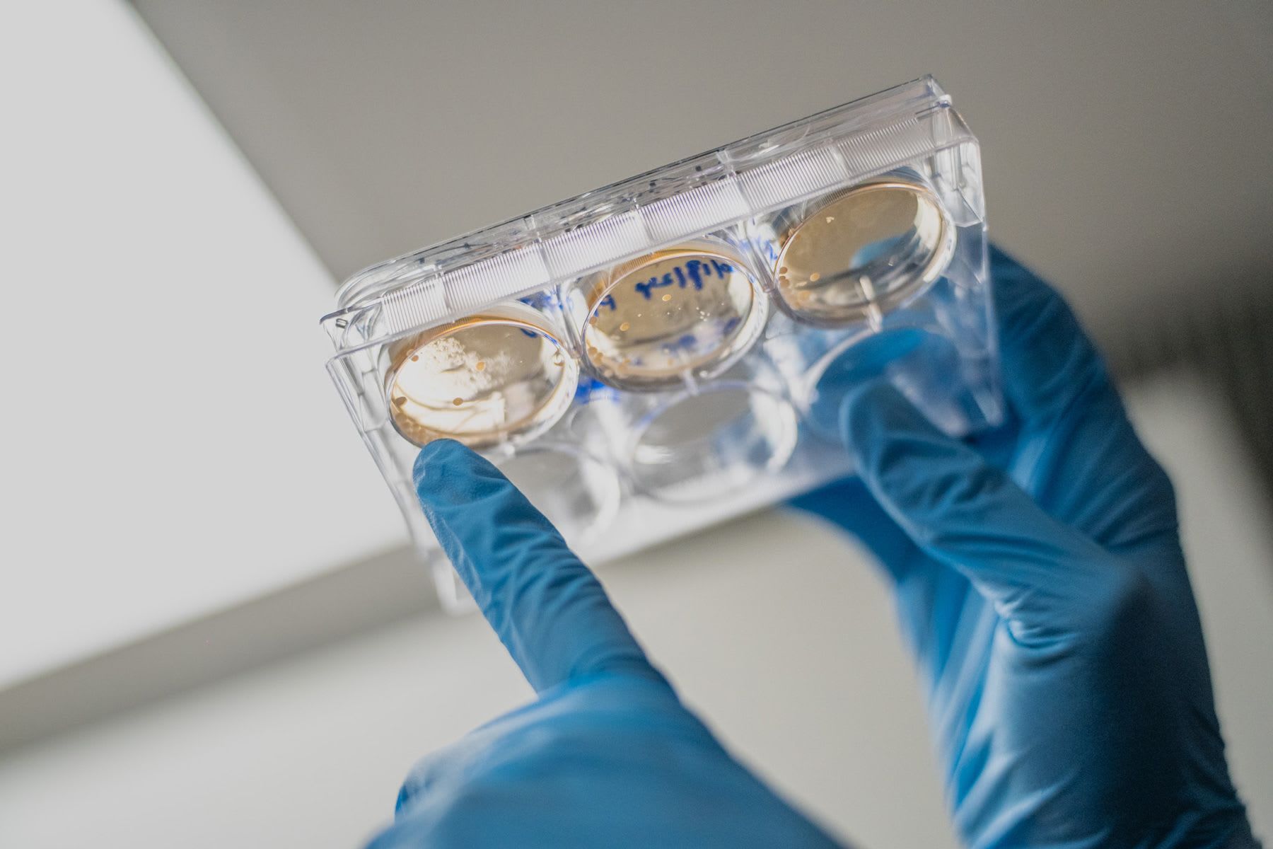 لقاح للسرطان