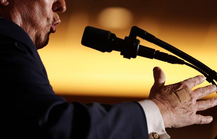 ما تفسير البيت الأبيض لوضع ترامب ضمادة على يده؟