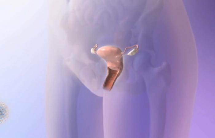 فيروس الورم الحليمي البشري.. السبب الأكثر شيوعًا لسرطان عنق الرحم وأشهر المفاهيم الخاطئة حوله