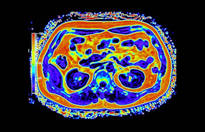 التصوير
      الجُزيئي
      كـ«بنية
      تحتية»:
      كيف
      يدعم
      التحول
      الصحي
      في
      السعودية؟