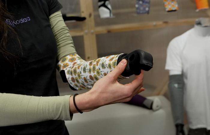 أطراف اصطناعية "مرنة" قد تساعد في حل مشكلة صحية عالمية