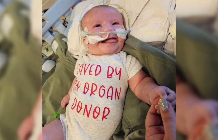 أول زراعة قلب جزئية لطفل رضيع ينجزها أطباء في مينيسوتا