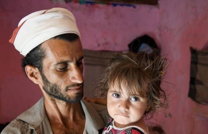 ألغام
      الحوثيين
      تفتك
      بأطفال
      اليمن
      رغم
      التهدئة
      على
      الجبهات