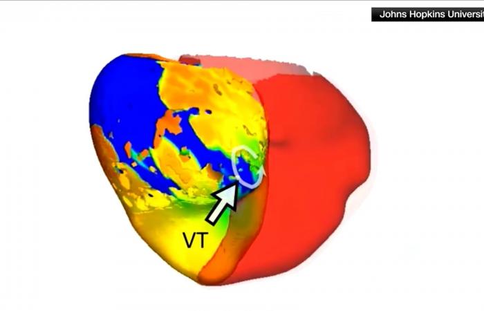 "نسخة رقمية" من قلبك على الكمبيوتر قد تنقذ حياتك.. كيف ذلك؟