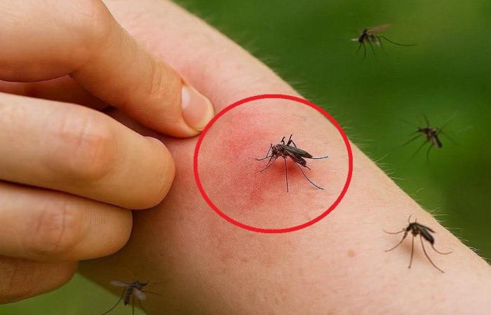 الرعاية الأولية تكشف مخاطر وأسباب انتشار النامس.. ما علاقة حمى الضنك؟ وهل يختار البعوض الأشخاص؟