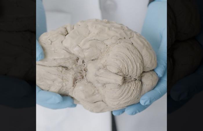 ​هل استخدام القنب آمن للجنين خلال فترة الحمل؟