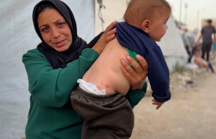 قوارض وآفات منتشرة.. أزمة صحية متفاقمة تلاحق أطفال غزة وسط تفشي الأمراض الجلدية