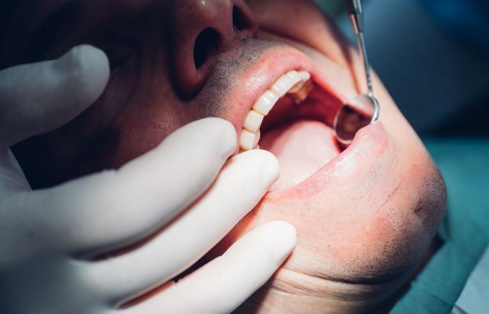 التهاب ضرس العقل..9 أعراض تنذر بهذه الحالة