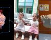 بمساعدة الذكاء الاصطناعي.. فصل توأم ملتصق في عملية جراحية معقدة استغرقت 40 ساعة